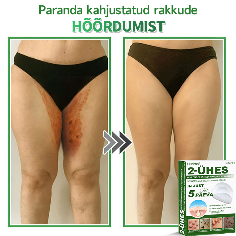 👍 𝐇𝐮𝐝𝐫𝐨𝐬® 𝟐-ü𝐡𝐞𝐬 𝐡ü𝐝𝐫𝐨𝐤𝐨𝐥𝐥𝐨𝐢𝐝𝐩𝐥𝐚𝐚𝐬𝐭𝐫𝐢𝐝 𝐦𝐢𝐤𝐫𝐨𝐧õ𝐞𝐥𝐭𝐞𝐠𝐚 | 𝐒𝐩𝐞𝐭𝐬𝐢𝐚𝐚𝐥𝐬𝐞𝐥𝐭 𝐯ä𝐥𝐣𝐚 𝐭öö𝐭𝐚𝐭𝐮𝐝 𝐯ä𝐥𝐣𝐚𝐮𝐥𝐚𝐭𝐮𝐯𝐚𝐭𝐞 𝐬ü𝐧𝐧𝐢𝐦ä𝐫𝐤𝐢𝐝𝐞, 𝐚𝐤𝐧𝐞, 𝐥𝐚𝐦𝐞𝐝𝐚𝐭𝐞 𝐭üü𝐠𝐚𝐬𝐭𝐞 𝐣𝐚 𝐧𝐚𝐡𝐚𝐦𝐨𝐨𝐝𝐮𝐬𝐭𝐢𝐬𝐭𝐞 𝐞𝐞𝐦𝐚𝐥𝐝𝐚𝐦𝐢𝐬𝐞𝐤𝐬 | 𝟏𝟒𝟒 𝐭ü𝐤𝐢𝐧𝐞 𝐩𝐚𝐤𝐞𝐧𝐝