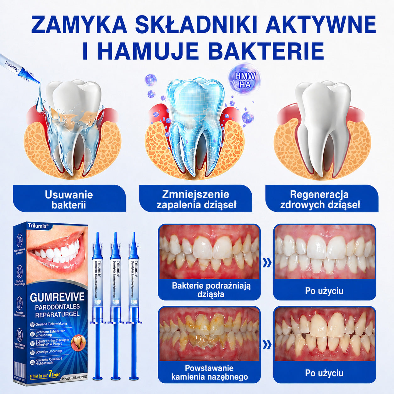 🇩🇪👨‍⚕️✅🦷Evolvion® GumRevive Parodontales Reparaturgel