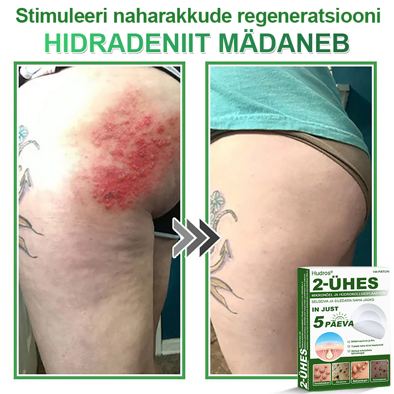 👍 𝐇𝐮𝐝𝐫𝐨𝐬® 𝟐-ü𝐡𝐞𝐬 𝐡ü𝐝𝐫𝐨𝐤𝐨𝐥𝐥𝐨𝐢𝐝𝐩𝐥𝐚𝐚𝐬𝐭𝐫𝐢𝐝 𝐦𝐢𝐤𝐫𝐨𝐧õ𝐞𝐥𝐭𝐞𝐠𝐚 | 𝐒𝐩𝐞𝐭𝐬𝐢𝐚𝐚𝐥𝐬𝐞𝐥𝐭 𝐯ä𝐥𝐣𝐚 𝐭öö𝐭𝐚𝐭𝐮𝐝 𝐯ä𝐥𝐣𝐚𝐮𝐥𝐚𝐭𝐮𝐯𝐚𝐭𝐞 𝐬ü𝐧𝐧𝐢𝐦ä𝐫𝐤𝐢𝐝𝐞, 𝐚𝐤𝐧𝐞, 𝐥𝐚𝐦𝐞𝐝𝐚𝐭𝐞 𝐭üü𝐠𝐚𝐬𝐭𝐞 𝐣𝐚 𝐧𝐚𝐡𝐚𝐦𝐨𝐨𝐝𝐮𝐬𝐭𝐢𝐬𝐭𝐞 𝐞𝐞𝐦𝐚𝐥𝐝𝐚𝐦𝐢𝐬𝐞𝐤𝐬 | 𝟏𝟒𝟒 𝐭ü𝐤𝐢𝐧𝐞 𝐩𝐚𝐤𝐞𝐧𝐝