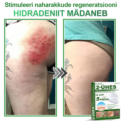 👍 𝐇𝐮𝐝𝐫𝐨𝐬® 𝟐-ü𝐡𝐞𝐬 𝐡ü𝐝𝐫𝐨𝐤𝐨𝐥𝐥𝐨𝐢𝐝𝐩𝐥𝐚𝐚𝐬𝐭𝐫𝐢𝐝 𝐦𝐢𝐤𝐫𝐨𝐧õ𝐞𝐥𝐭𝐞𝐠𝐚 | 𝐒𝐩𝐞𝐭𝐬𝐢𝐚𝐚𝐥𝐬𝐞𝐥𝐭 𝐯ä𝐥𝐣𝐚 𝐭öö𝐭𝐚𝐭𝐮𝐝 𝐯ä𝐥𝐣𝐚𝐮𝐥𝐚𝐭𝐮𝐯𝐚𝐭𝐞 𝐬ü𝐧𝐧𝐢𝐦ä𝐫𝐤𝐢𝐝𝐞, 𝐚𝐤𝐧𝐞, 𝐥𝐚𝐦𝐞𝐝𝐚𝐭𝐞 𝐭üü𝐠𝐚𝐬𝐭𝐞 𝐣𝐚 𝐧𝐚𝐡𝐚𝐦𝐨𝐨𝐝𝐮𝐬𝐭𝐢𝐬𝐭𝐞 𝐞𝐞𝐦𝐚𝐥𝐝𝐚𝐦𝐢𝐬𝐞𝐤𝐬 | 𝟏𝟒𝟒 𝐭ü𝐤𝐢𝐧𝐞 𝐩𝐚𝐤𝐞𝐧𝐝