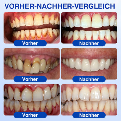 🇩🇪👨‍⚕️✅🦷Evolvion® GumRevive Parodontales Reparaturgel