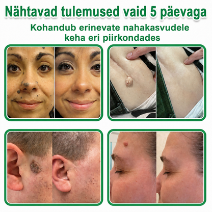 👍 𝐇𝐮𝐝𝐫𝐨𝐬® 𝟐-ü𝐡𝐞𝐬 𝐡ü𝐝𝐫𝐨𝐤𝐨𝐥𝐥𝐨𝐢𝐝𝐩𝐥𝐚𝐚𝐬𝐭𝐫𝐢𝐝 𝐦𝐢𝐤𝐫𝐨𝐧õ𝐞𝐥𝐭𝐞𝐠𝐚 | 𝐒𝐩𝐞𝐭𝐬𝐢𝐚𝐚𝐥𝐬𝐞𝐥𝐭 𝐯ä𝐥𝐣𝐚 𝐭öö𝐭𝐚𝐭𝐮𝐝 𝐯ä𝐥𝐣𝐚𝐮𝐥𝐚𝐭𝐮𝐯𝐚𝐭𝐞 𝐬ü𝐧𝐧𝐢𝐦ä𝐫𝐤𝐢𝐝𝐞, 𝐚𝐤𝐧𝐞, 𝐥𝐚𝐦𝐞𝐝𝐚𝐭𝐞 𝐭üü𝐠𝐚𝐬𝐭𝐞 𝐣𝐚 𝐧𝐚𝐡𝐚𝐦𝐨𝐨𝐝𝐮𝐬𝐭𝐢𝐬𝐭𝐞 𝐞𝐞𝐦𝐚𝐥𝐝𝐚𝐦𝐢𝐬𝐞𝐤𝐬 | 𝟏𝟒𝟒 𝐭ü𝐤𝐢𝐧𝐞 𝐩𝐚𝐤𝐞𝐧𝐝