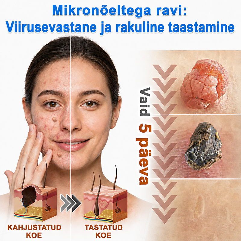 👍 𝐇𝐮𝐝𝐫𝐨𝐬® 𝟐-ü𝐡𝐞𝐬 𝐡ü𝐝𝐫𝐨𝐤𝐨𝐥𝐥𝐨𝐢𝐝𝐩𝐥𝐚𝐚𝐬𝐭𝐫𝐢𝐝 𝐦𝐢𝐤𝐫𝐨𝐧õ𝐞𝐥𝐭𝐞𝐠𝐚 | 𝐒𝐩𝐞𝐭𝐬𝐢𝐚𝐚𝐥𝐬𝐞𝐥𝐭 𝐯ä𝐥𝐣𝐚 𝐭öö𝐭𝐚𝐭𝐮𝐝 𝐯ä𝐥𝐣𝐚𝐮𝐥𝐚𝐭𝐮𝐯𝐚𝐭𝐞 𝐬ü𝐧𝐧𝐢𝐦ä𝐫𝐤𝐢𝐝𝐞, 𝐚𝐤𝐧𝐞, 𝐥𝐚𝐦𝐞𝐝𝐚𝐭𝐞 𝐭üü𝐠𝐚𝐬𝐭𝐞 𝐣𝐚 𝐧𝐚𝐡𝐚𝐦𝐨𝐨𝐝𝐮𝐬𝐭𝐢𝐬𝐭𝐞 𝐞𝐞𝐦𝐚𝐥𝐝𝐚𝐦𝐢𝐬𝐞𝐤𝐬 | 𝟏𝟒𝟒 𝐭ü𝐤𝐢𝐧𝐞 𝐩𝐚𝐤𝐞𝐧𝐝