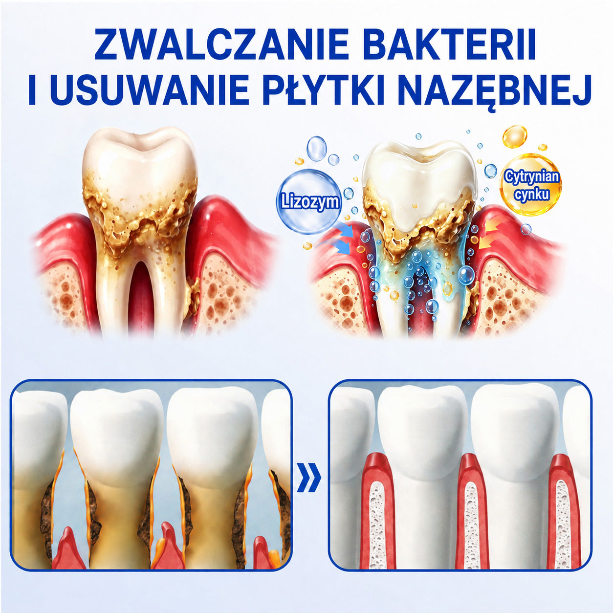 🇩🇪👨‍⚕️✅🦷Evolvion® GumRevive Parodontales Reparaturgel