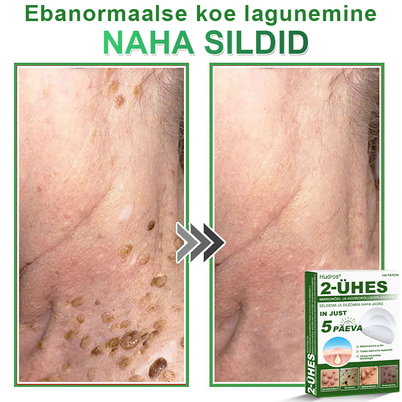 👍 𝐇𝐮𝐝𝐫𝐨𝐬® 𝟐-ü𝐡𝐞𝐬 𝐡ü𝐝𝐫𝐨𝐤𝐨𝐥𝐥𝐨𝐢𝐝𝐩𝐥𝐚𝐚𝐬𝐭𝐫𝐢𝐝 𝐦𝐢𝐤𝐫𝐨𝐧õ𝐞𝐥𝐭𝐞𝐠𝐚 | 𝐒𝐩𝐞𝐭𝐬𝐢𝐚𝐚𝐥𝐬𝐞𝐥𝐭 𝐯ä𝐥𝐣𝐚 𝐭öö𝐭𝐚𝐭𝐮𝐝 𝐯ä𝐥𝐣𝐚𝐮𝐥𝐚𝐭𝐮𝐯𝐚𝐭𝐞 𝐬ü𝐧𝐧𝐢𝐦ä𝐫𝐤𝐢𝐝𝐞, 𝐚𝐤𝐧𝐞, 𝐥𝐚𝐦𝐞𝐝𝐚𝐭𝐞 𝐭üü𝐠𝐚𝐬𝐭𝐞 𝐣𝐚 𝐧𝐚𝐡𝐚𝐦𝐨𝐨𝐝𝐮𝐬𝐭𝐢𝐬𝐭𝐞 𝐞𝐞𝐦𝐚𝐥𝐝𝐚𝐦𝐢𝐬𝐞𝐤𝐬 | 𝟏𝟒𝟒 𝐭ü𝐤𝐢𝐧𝐞 𝐩𝐚𝐤𝐞𝐧𝐝