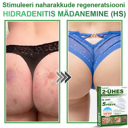 👍 𝐇𝐮𝐝𝐫𝐨𝐬® 𝟐-ü𝐡𝐞𝐬 𝐡ü𝐝𝐫𝐨𝐤𝐨𝐥𝐥𝐨𝐢𝐝𝐩𝐥𝐚𝐚𝐬𝐭𝐫𝐢𝐝 𝐦𝐢𝐤𝐫𝐨𝐧õ𝐞𝐥𝐭𝐞𝐠𝐚 | 𝐒𝐩𝐞𝐭𝐬𝐢𝐚𝐚𝐥𝐬𝐞𝐥𝐭 𝐯ä𝐥𝐣𝐚 𝐭öö𝐭𝐚𝐭𝐮𝐝 𝐯ä𝐥𝐣𝐚𝐮𝐥𝐚𝐭𝐮𝐯𝐚𝐭𝐞 𝐬ü𝐧𝐧𝐢𝐦ä𝐫𝐤𝐢𝐝𝐞, 𝐚𝐤𝐧𝐞, 𝐥𝐚𝐦𝐞𝐝𝐚𝐭𝐞 𝐭üü𝐠𝐚𝐬𝐭𝐞 𝐣𝐚 𝐧𝐚𝐡𝐚𝐦𝐨𝐨𝐝𝐮𝐬𝐭𝐢𝐬𝐭𝐞 𝐞𝐞𝐦𝐚𝐥𝐝𝐚𝐦𝐢𝐬𝐞𝐤𝐬 | 𝟏𝟒𝟒 𝐭ü𝐤𝐢𝐧𝐞 𝐩𝐚𝐤𝐞𝐧𝐝