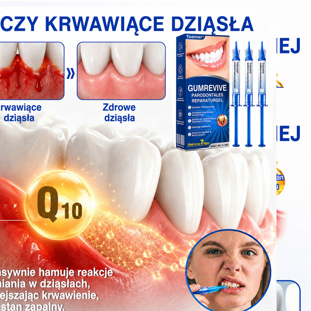 🇩🇪👨‍⚕️✅🦷Evolvion® GumRevive Parodontales Reparaturgel