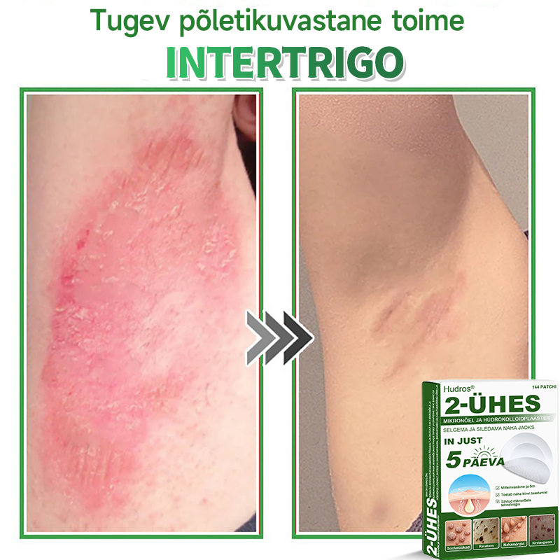👍 𝐇𝐮𝐝𝐫𝐨𝐬® 𝟐-ü𝐡𝐞𝐬 𝐡ü𝐝𝐫𝐨𝐤𝐨𝐥𝐥𝐨𝐢𝐝𝐩𝐥𝐚𝐚𝐬𝐭𝐫𝐢𝐝 𝐦𝐢𝐤𝐫𝐨𝐧õ𝐞𝐥𝐭𝐞𝐠𝐚 | 𝐒𝐩𝐞𝐭𝐬𝐢𝐚𝐚𝐥𝐬𝐞𝐥𝐭 𝐯ä𝐥𝐣𝐚 𝐭öö𝐭𝐚𝐭𝐮𝐝 𝐯ä𝐥𝐣𝐚𝐮𝐥𝐚𝐭𝐮𝐯𝐚𝐭𝐞 𝐬ü𝐧𝐧𝐢𝐦ä𝐫𝐤𝐢𝐝𝐞, 𝐚𝐤𝐧𝐞, 𝐥𝐚𝐦𝐞𝐝𝐚𝐭𝐞 𝐭üü𝐠𝐚𝐬𝐭𝐞 𝐣𝐚 𝐧𝐚𝐡𝐚𝐦𝐨𝐨𝐝𝐮𝐬𝐭𝐢𝐬𝐭𝐞 𝐞𝐞𝐦𝐚𝐥𝐝𝐚𝐦𝐢𝐬𝐞𝐤𝐬 | 𝟏𝟒𝟒 𝐭ü𝐤𝐢𝐧𝐞 𝐩𝐚𝐤𝐞𝐧𝐝