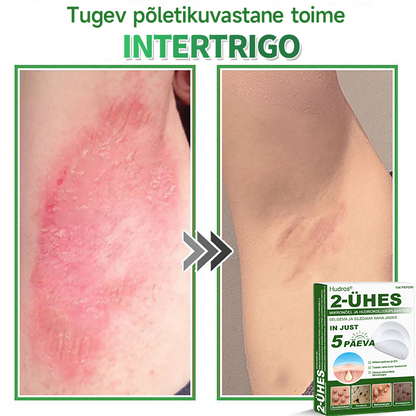 👍 𝐇𝐮𝐝𝐫𝐨𝐬® 𝟐-ü𝐡𝐞𝐬 𝐡ü𝐝𝐫𝐨𝐤𝐨𝐥𝐥𝐨𝐢𝐝𝐩𝐥𝐚𝐚𝐬𝐭𝐫𝐢𝐝 𝐦𝐢𝐤𝐫𝐨𝐧õ𝐞𝐥𝐭𝐞𝐠𝐚 | 𝐒𝐩𝐞𝐭𝐬𝐢𝐚𝐚𝐥𝐬𝐞𝐥𝐭 𝐯ä𝐥𝐣𝐚 𝐭öö𝐭𝐚𝐭𝐮𝐝 𝐯ä𝐥𝐣𝐚𝐮𝐥𝐚𝐭𝐮𝐯𝐚𝐭𝐞 𝐬ü𝐧𝐧𝐢𝐦ä𝐫𝐤𝐢𝐝𝐞, 𝐚𝐤𝐧𝐞, 𝐥𝐚𝐦𝐞𝐝𝐚𝐭𝐞 𝐭üü𝐠𝐚𝐬𝐭𝐞 𝐣𝐚 𝐧𝐚𝐡𝐚𝐦𝐨𝐨𝐝𝐮𝐬𝐭𝐢𝐬𝐭𝐞 𝐞𝐞𝐦𝐚𝐥𝐝𝐚𝐦𝐢𝐬𝐞𝐤𝐬 | 𝟏𝟒𝟒 𝐭ü𝐤𝐢𝐧𝐞 𝐩𝐚𝐤𝐞𝐧𝐝