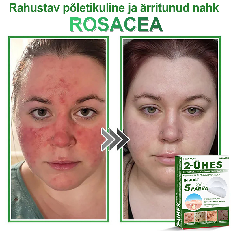 👍 𝐇𝐮𝐝𝐫𝐨𝐬® 𝟐-ü𝐡𝐞𝐬 𝐡ü𝐝𝐫𝐨𝐤𝐨𝐥𝐥𝐨𝐢𝐝𝐩𝐥𝐚𝐚𝐬𝐭𝐫𝐢𝐝 𝐦𝐢𝐤𝐫𝐨𝐧õ𝐞𝐥𝐭𝐞𝐠𝐚 | 𝐒𝐩𝐞𝐭𝐬𝐢𝐚𝐚𝐥𝐬𝐞𝐥𝐭 𝐯ä𝐥𝐣𝐚 𝐭öö𝐭𝐚𝐭𝐮𝐝 𝐯ä𝐥𝐣𝐚𝐮𝐥𝐚𝐭𝐮𝐯𝐚𝐭𝐞 𝐬ü𝐧𝐧𝐢𝐦ä𝐫𝐤𝐢𝐝𝐞, 𝐚𝐤𝐧𝐞, 𝐥𝐚𝐦𝐞𝐝𝐚𝐭𝐞 𝐭üü𝐠𝐚𝐬𝐭𝐞 𝐣𝐚 𝐧𝐚𝐡𝐚𝐦𝐨𝐨𝐝𝐮𝐬𝐭𝐢𝐬𝐭𝐞 𝐞𝐞𝐦𝐚𝐥𝐝𝐚𝐦𝐢𝐬𝐞𝐤𝐬 | 𝟏𝟒𝟒 𝐭ü𝐤𝐢𝐧𝐞 𝐩𝐚𝐤𝐞𝐧𝐝