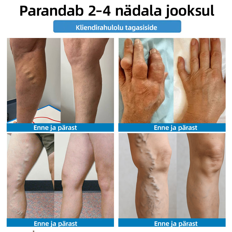 𝐏𝐈𝐈𝐑𝐀𝐓𝐔𝐃 𝐏𝐀𝐊𝐊𝐔𝐌𝐈𝐍𝐄 -𝟖𝟎% | 𝐇𝐞𝐚𝐥𝐫𝐢𝐳𝐞® 𝟒-𝐢𝐧-𝟏 𝐕𝐞𝐢𝐧 & 𝐉𝐨𝐢𝐧𝐭 𝐍𝐚𝐧𝐨 𝐌𝐢𝐜𝐫𝐨𝐧𝐞𝐞𝐝𝐥𝐞 𝐀𝐝𝐯𝐚𝐧𝐜𝐞𝐝 𝐓𝐡𝐞𝐫𝐚𝐩𝐲 𝐏𝐚𝐭𝐜𝐡 💪 𝐊𝐢𝐢𝐫𝐞 𝐋𝐞𝐞𝐯𝐞𝐧𝐝𝐮𝐬, 𝐏𝐢𝐤𝐚𝐚𝐣𝐚𝐥𝐢𝐬𝐞𝐝 𝐓𝐮𝐥𝐞𝐦𝐮𝐬𝐞𝐝