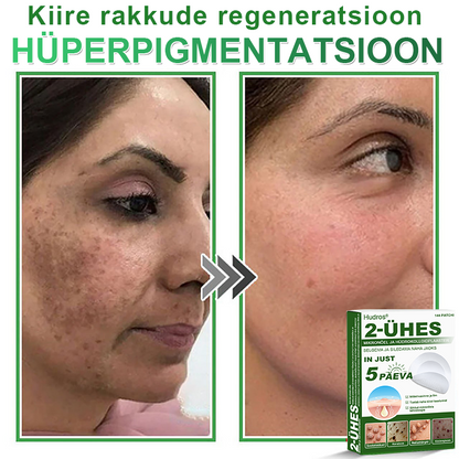👍 𝐇𝐮𝐝𝐫𝐨𝐬® 𝟐-ü𝐡𝐞𝐬 𝐡ü𝐝𝐫𝐨𝐤𝐨𝐥𝐥𝐨𝐢𝐝𝐩𝐥𝐚𝐚𝐬𝐭𝐫𝐢𝐝 𝐦𝐢𝐤𝐫𝐨𝐧õ𝐞𝐥𝐭𝐞𝐠𝐚 | 𝐒𝐩𝐞𝐭𝐬𝐢𝐚𝐚𝐥𝐬𝐞𝐥𝐭 𝐯ä𝐥𝐣𝐚 𝐭öö𝐭𝐚𝐭𝐮𝐝 𝐯ä𝐥𝐣𝐚𝐮𝐥𝐚𝐭𝐮𝐯𝐚𝐭𝐞 𝐬ü𝐧𝐧𝐢𝐦ä𝐫𝐤𝐢𝐝𝐞, 𝐚𝐤𝐧𝐞, 𝐥𝐚𝐦𝐞𝐝𝐚𝐭𝐞 𝐭üü𝐠𝐚𝐬𝐭𝐞 𝐣𝐚 𝐧𝐚𝐡𝐚𝐦𝐨𝐨𝐝𝐮𝐬𝐭𝐢𝐬𝐭𝐞 𝐞𝐞𝐦𝐚𝐥𝐝𝐚𝐦𝐢𝐬𝐞𝐤𝐬 | 𝟏𝟒𝟒 𝐭ü𝐤𝐢𝐧𝐞 𝐩𝐚𝐤𝐞𝐧𝐝