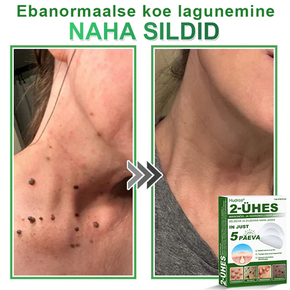 👍 𝐇𝐮𝐝𝐫𝐨𝐬® 𝟐-ü𝐡𝐞𝐬 𝐡ü𝐝𝐫𝐨𝐤𝐨𝐥𝐥𝐨𝐢𝐝𝐩𝐥𝐚𝐚𝐬𝐭𝐫𝐢𝐝 𝐦𝐢𝐤𝐫𝐨𝐧õ𝐞𝐥𝐭𝐞𝐠𝐚 | 𝐒𝐩𝐞𝐭𝐬𝐢𝐚𝐚𝐥𝐬𝐞𝐥𝐭 𝐯ä𝐥𝐣𝐚 𝐭öö𝐭𝐚𝐭𝐮𝐝 𝐯ä𝐥𝐣𝐚𝐮𝐥𝐚𝐭𝐮𝐯𝐚𝐭𝐞 𝐬ü𝐧𝐧𝐢𝐦ä𝐫𝐤𝐢𝐝𝐞, 𝐚𝐤𝐧𝐞, 𝐥𝐚𝐦𝐞𝐝𝐚𝐭𝐞 𝐭üü𝐠𝐚𝐬𝐭𝐞 𝐣𝐚 𝐧𝐚𝐡𝐚𝐦𝐨𝐨𝐝𝐮𝐬𝐭𝐢𝐬𝐭𝐞 𝐞𝐞𝐦𝐚𝐥𝐝𝐚𝐦𝐢𝐬𝐞𝐤𝐬 | 𝟏𝟒𝟒 𝐭ü𝐤𝐢𝐧𝐞 𝐩𝐚𝐤𝐞𝐧𝐝