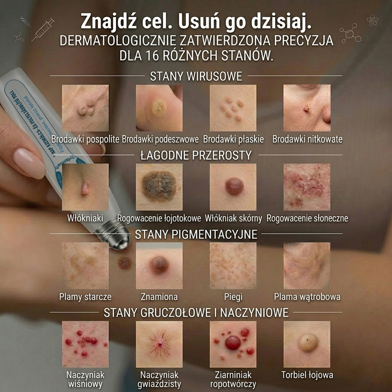 𝐎𝐟𝐢𝐜𝐣𝐚𝐥𝐧𝐲 𝐬𝐤𝐥𝐞𝐩 𝐦𝐚𝐫𝐤𝐢 | ✅️ Trilumia® 7-dniowy preparat na narośle skórne i przebarwienia (bezbolesny aplikator roll-on, bez blizn) 😍