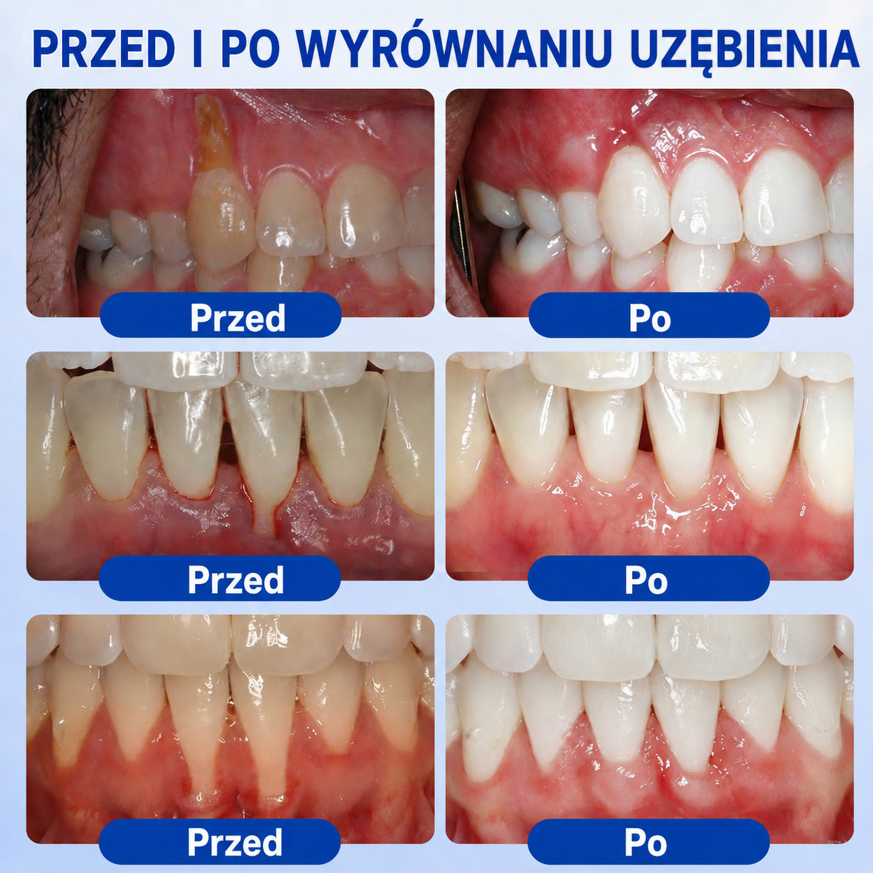 🇩🇪👨‍⚕️✅🦷Evolvion® GumRevive Parodontales Reparaturgel