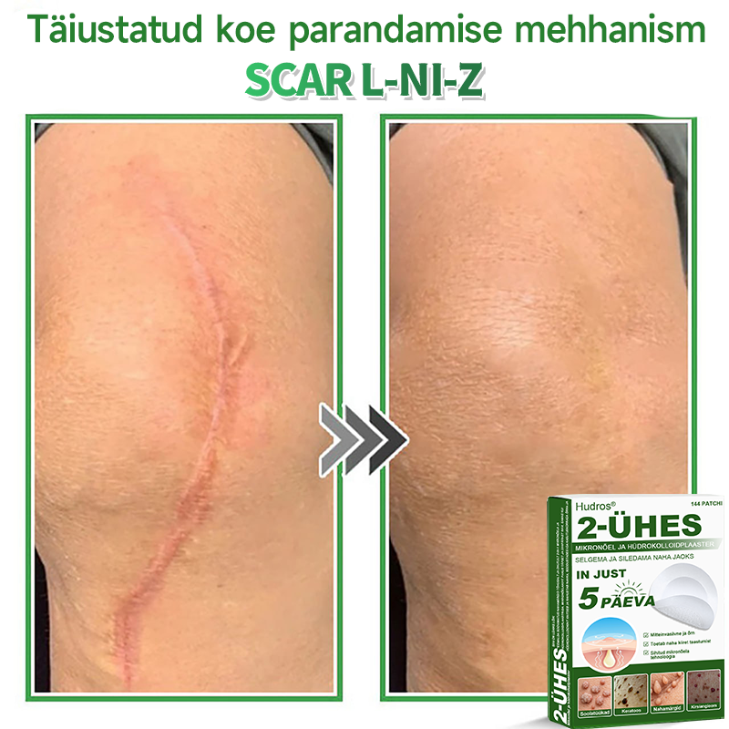 👍 𝐇𝐮𝐝𝐫𝐨𝐬® 𝟐-ü𝐡𝐞𝐬 𝐡ü𝐝𝐫𝐨𝐤𝐨𝐥𝐥𝐨𝐢𝐝𝐩𝐥𝐚𝐚𝐬𝐭𝐫𝐢𝐝 𝐦𝐢𝐤𝐫𝐨𝐧õ𝐞𝐥𝐭𝐞𝐠𝐚 | 𝐒𝐩𝐞𝐭𝐬𝐢𝐚𝐚𝐥𝐬𝐞𝐥𝐭 𝐯ä𝐥𝐣𝐚 𝐭öö𝐭𝐚𝐭𝐮𝐝 𝐯ä𝐥𝐣𝐚𝐮𝐥𝐚𝐭𝐮𝐯𝐚𝐭𝐞 𝐬ü𝐧𝐧𝐢𝐦ä𝐫𝐤𝐢𝐝𝐞, 𝐚𝐤𝐧𝐞, 𝐥𝐚𝐦𝐞𝐝𝐚𝐭𝐞 𝐭üü𝐠𝐚𝐬𝐭𝐞 𝐣𝐚 𝐧𝐚𝐡𝐚𝐦𝐨𝐨𝐝𝐮𝐬𝐭𝐢𝐬𝐭𝐞 𝐞𝐞𝐦𝐚𝐥𝐝𝐚𝐦𝐢𝐬𝐞𝐤𝐬 | 𝟏𝟒𝟒 𝐭ü𝐤𝐢𝐧𝐞 𝐩𝐚𝐤𝐞𝐧𝐝