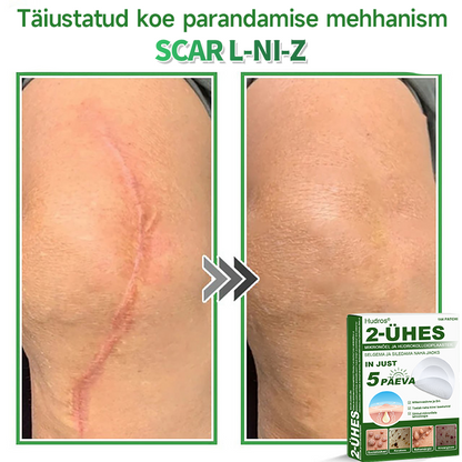 👍 𝐇𝐮𝐝𝐫𝐨𝐬® 𝟐-ü𝐡𝐞𝐬 𝐡ü𝐝𝐫𝐨𝐤𝐨𝐥𝐥𝐨𝐢𝐝𝐩𝐥𝐚𝐚𝐬𝐭𝐫𝐢𝐝 𝐦𝐢𝐤𝐫𝐨𝐧õ𝐞𝐥𝐭𝐞𝐠𝐚 | 𝐒𝐩𝐞𝐭𝐬𝐢𝐚𝐚𝐥𝐬𝐞𝐥𝐭 𝐯ä𝐥𝐣𝐚 𝐭öö𝐭𝐚𝐭𝐮𝐝 𝐯ä𝐥𝐣𝐚𝐮𝐥𝐚𝐭𝐮𝐯𝐚𝐭𝐞 𝐬ü𝐧𝐧𝐢𝐦ä𝐫𝐤𝐢𝐝𝐞, 𝐚𝐤𝐧𝐞, 𝐥𝐚𝐦𝐞𝐝𝐚𝐭𝐞 𝐭üü𝐠𝐚𝐬𝐭𝐞 𝐣𝐚 𝐧𝐚𝐡𝐚𝐦𝐨𝐨𝐝𝐮𝐬𝐭𝐢𝐬𝐭𝐞 𝐞𝐞𝐦𝐚𝐥𝐝𝐚𝐦𝐢𝐬𝐞𝐤𝐬 | 𝟏𝟒𝟒 𝐭ü𝐤𝐢𝐧𝐞 𝐩𝐚𝐤𝐞𝐧𝐝