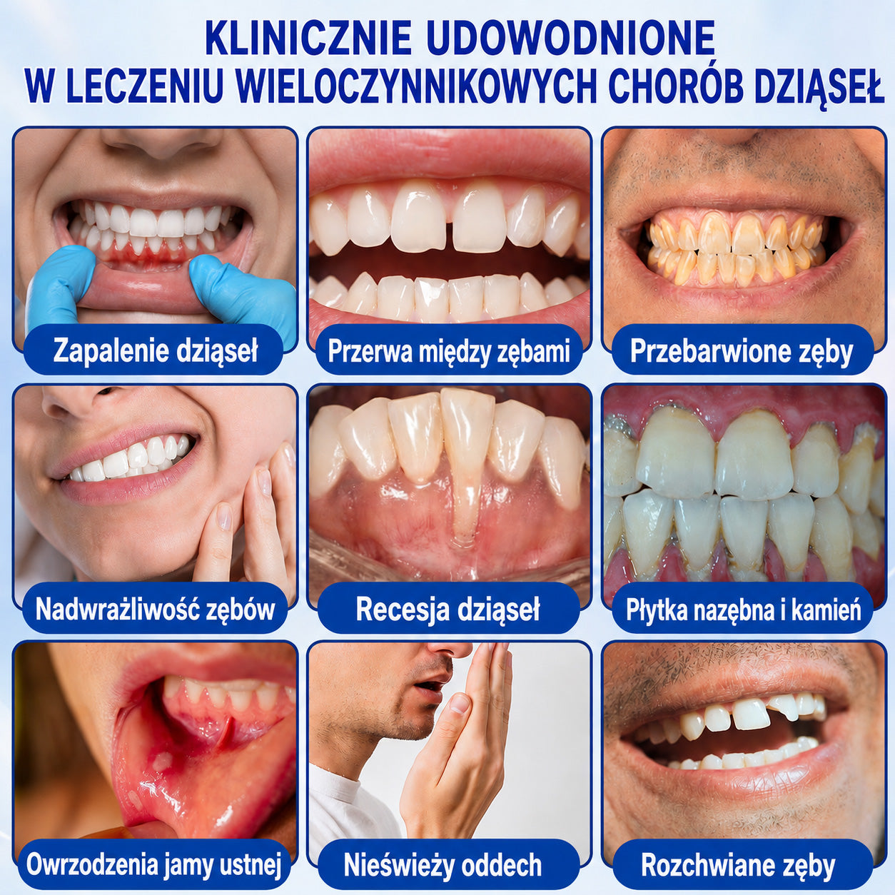 🇩🇪👨‍⚕️✅🦷Evolvion® GumRevive Parodontales Reparaturgel
